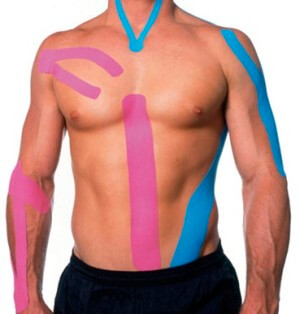 kinesio taping